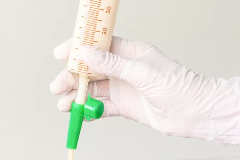 Ob Patienten von künstlicher Ernährung profitieren, hängt von vielen Faktoren ab. Die AOK gibt eine Entscheidungshilfe.